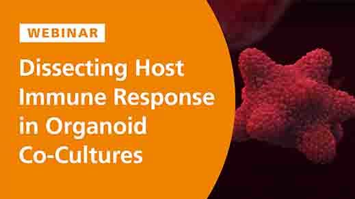 Dissecting the Innate Immune Response in Human Intestinal Organoid Models