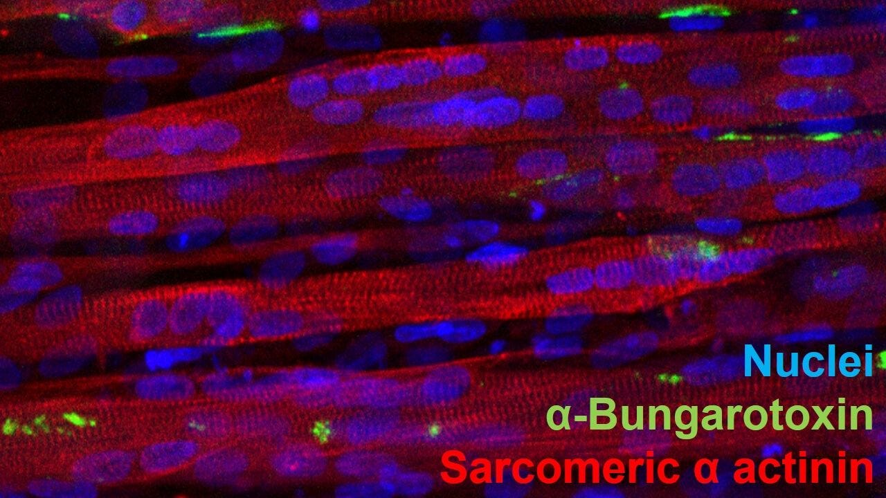 3D Modeling of Skeletal Muscle for In Vitro Functional Assaying