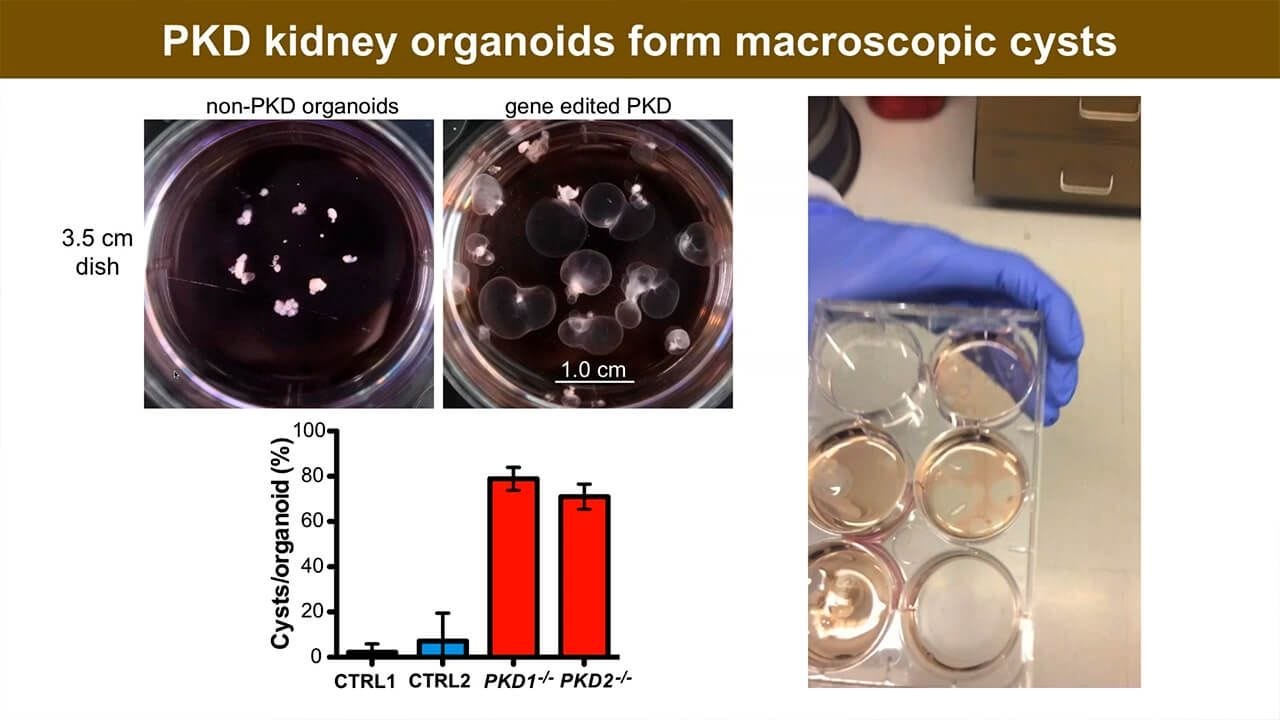 Re-Creating Disease with Kidney Organoids and CRISPR