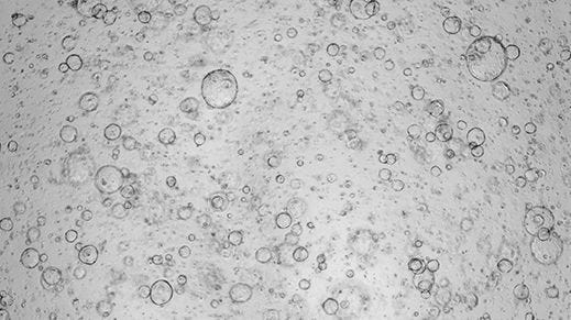 Expansion of Hepatic Organoids via Single Cells Using HepatiCult™ Organoid Growth Medium