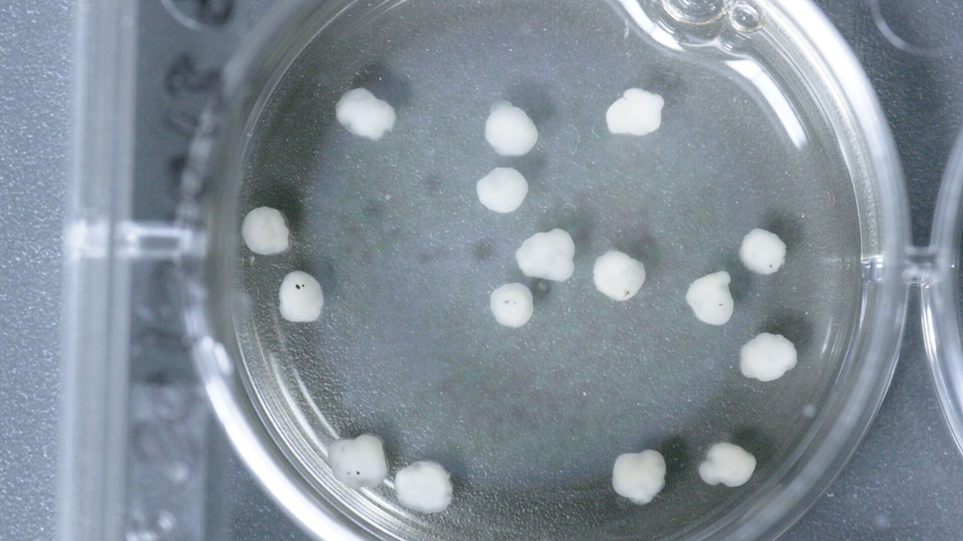 How to Grow Cerebral Organoids from Human Pluripotent Stem Cells