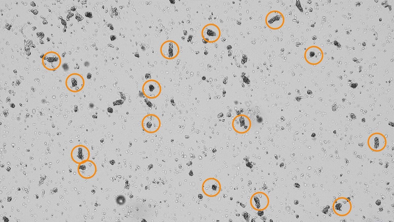 How to Count Intestinal Crypts for Mouse Organoid Cultures