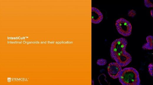 Intestinal Organoids: Improved Tools and In Vitro Models for Drug Development