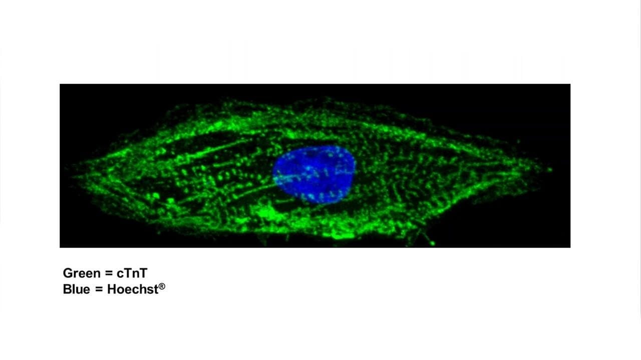 Modeling Arrhythmias Using hPSC-Derived Cardiomyocytes and Tracking Their Excitability
