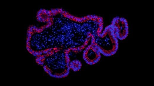 How to Passage Mouse Intestinal Organoids
