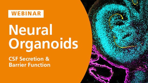 Modeling Brain Barrier Permeability and CSF Secretion with Choroid Plexus Organoids