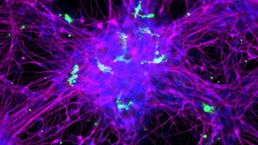 How to Co-Culture Human Pluripotent Stem Cell (hPSC)-Derived Forebrain Neurons and Microglia