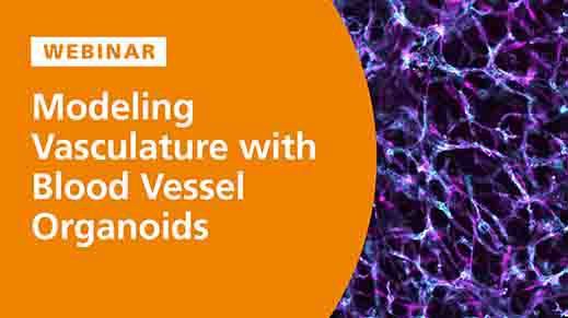 Modeling the Structural and Functional Features of Blood Vasculature with Blood Vessel Organoids