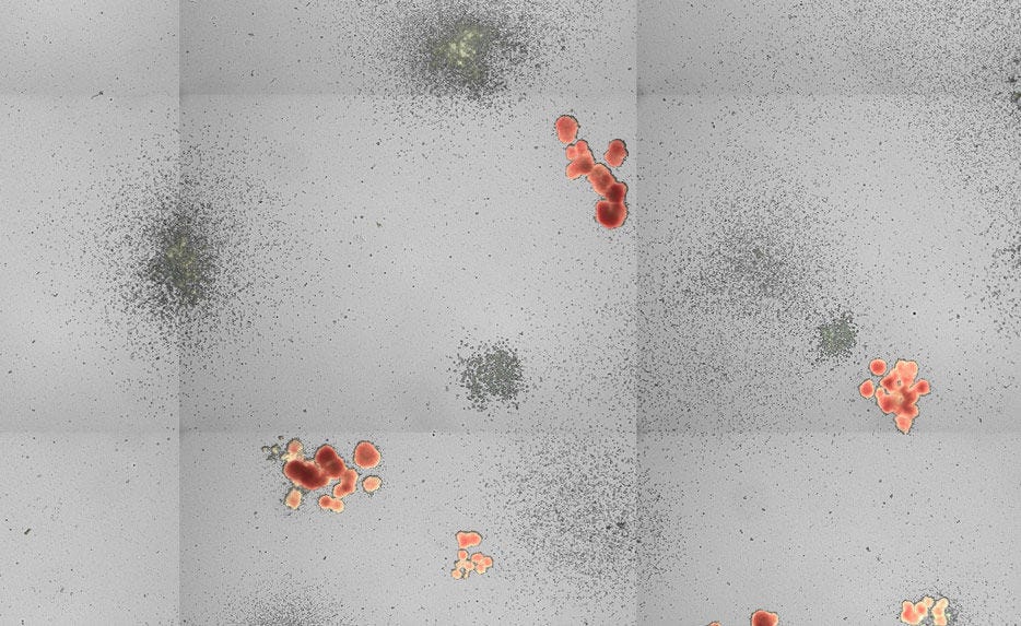 Human Cord Blood Colonies Plated in MethoCult™ Optimum H4034, Imaged on STEMvision™ Instrument