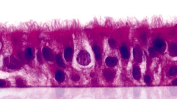 Pseudostratified airway epithelium at the air-liquid interface