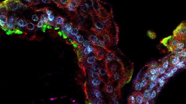 Immunostained airway organoids