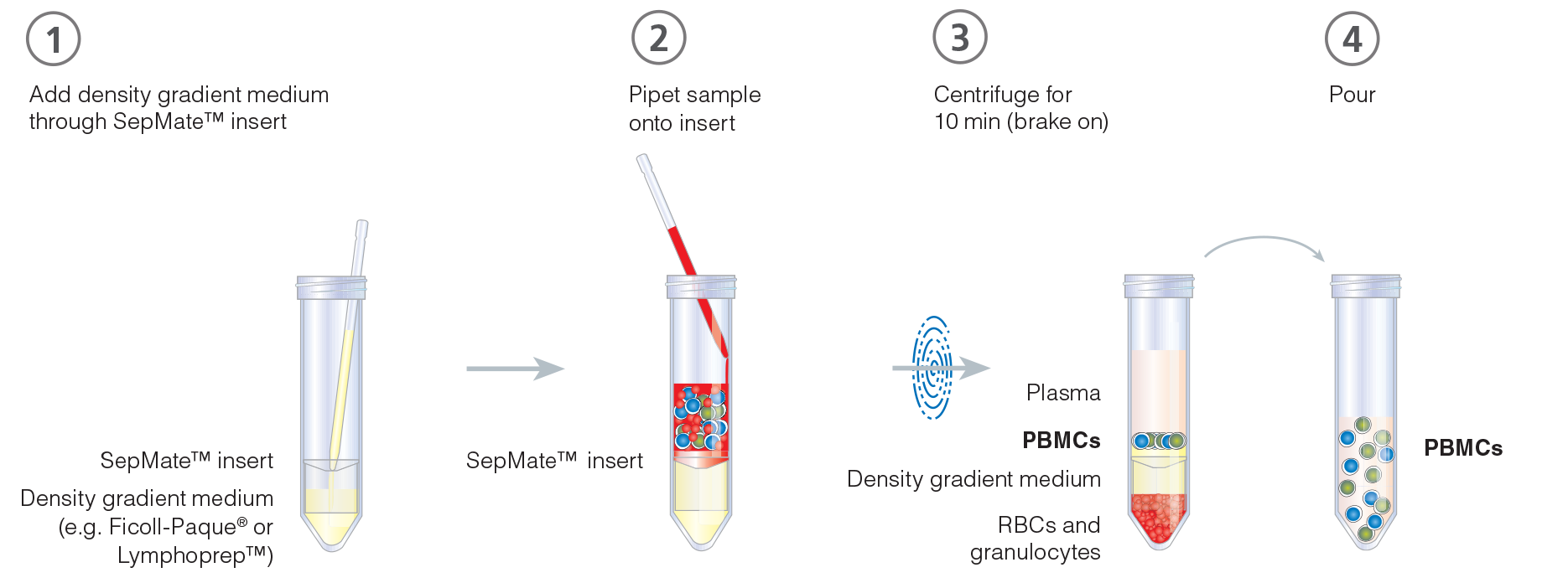 Typical SepMate™ PBMC isolation protocol