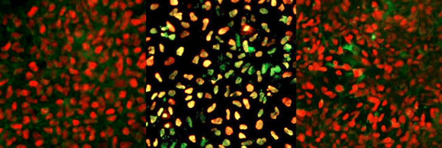 PSC trilineage differentiation