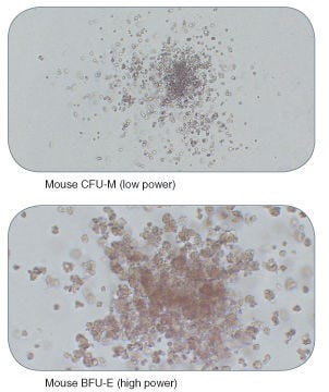 Examples of Colonies Derived from Mouse Hematopoietic Progenitors