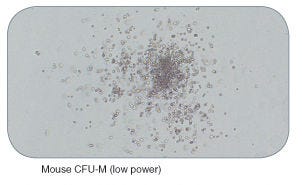 Examples of Colonies Derived From Mouse Hematopoietic Progenitors