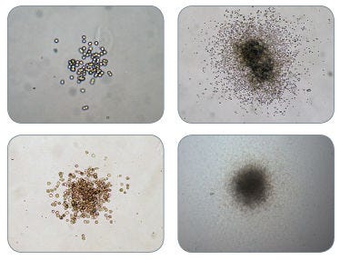 Examples of Colonies Derived from CFU-GM in MethoCult™ H4034 Optimum