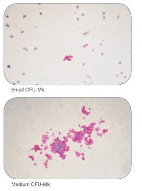 Examples of colonies derived from human megakaryocyte progenitors