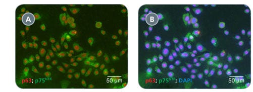 HBECs Cultured in PneumaCult™-Ex Exhibit Uniform Expression of Basal Cell Markers