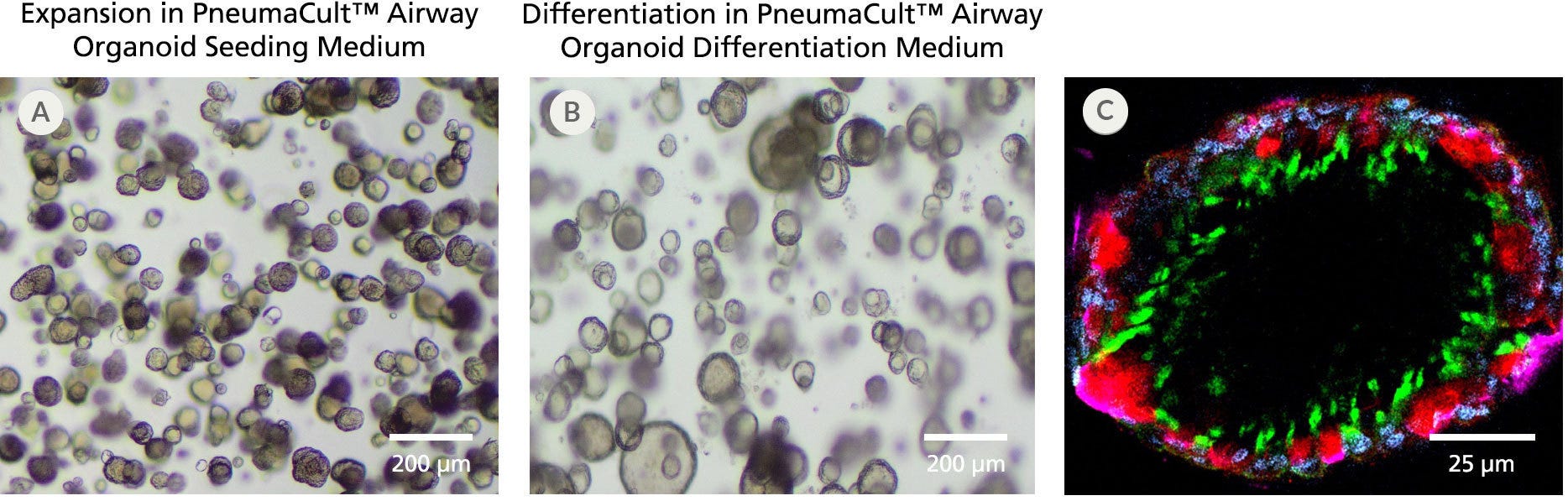 Fully differentiated human airway organoids generated using PneumaCult™ Airway Organoid Kit display physiologically relevant morphology.