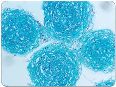 Human MSC Chondrogenic Differentiation With AggreWell™800 Plates