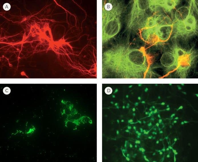 Differentiation of Mouse Neural Stem Cells Using NeuroCult™