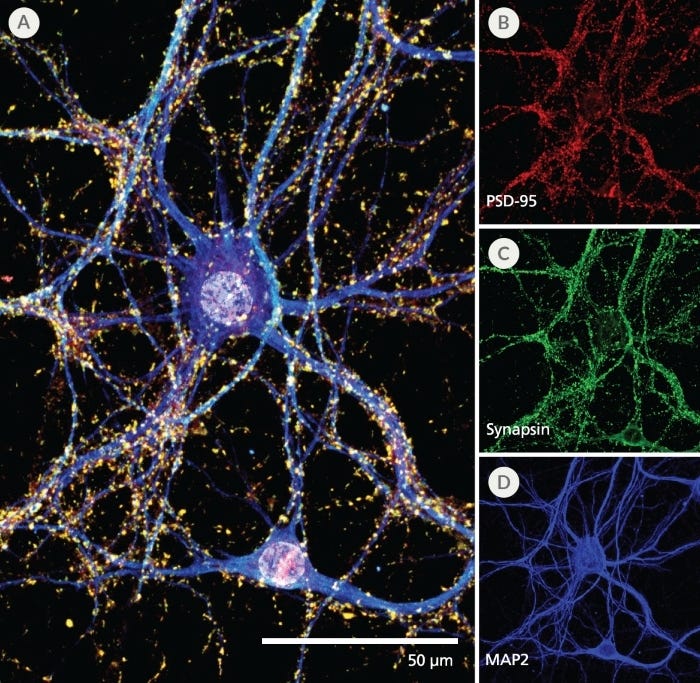 Neurite Outgrowth of Primary Neurons Cultured in NeuroCult™ SM1 and TSFM for 7 and 21 Days