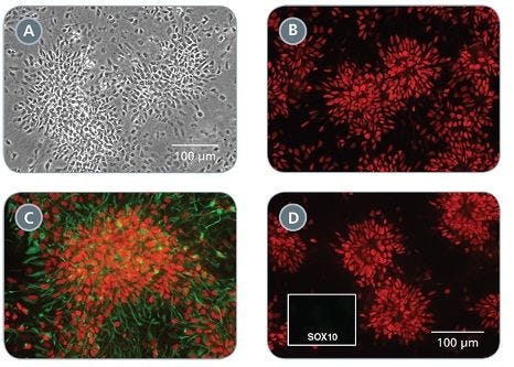 Morphology and Marker Expression of Neural Progenitor Cells Cultured in STEMdiff™ Neural Progenitor Medium