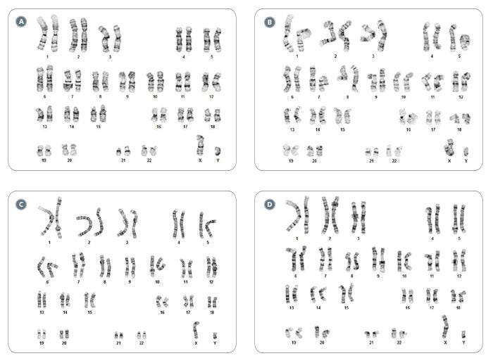 hPSCs Frozen and Thawed as Single Cells with FreSR™-S Display a Normal Karyotype