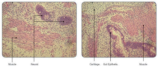 hESCs Cultured in TeSR™2 Are Pluripotent