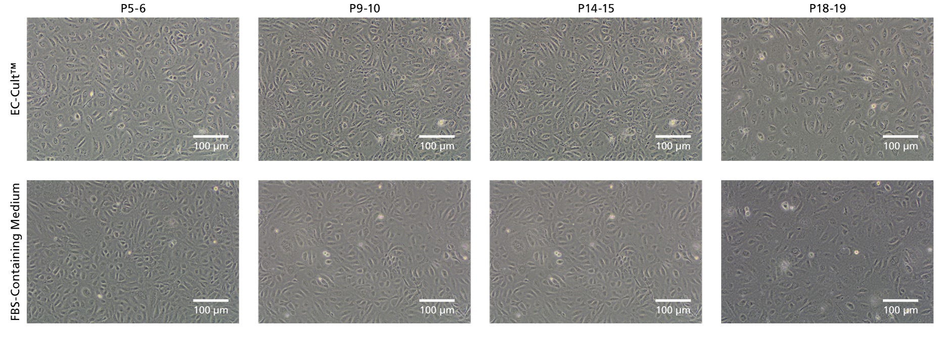 EC-Cult™ Medium Enables Long-Term Expansion of HUVECs in an FBS-Free Setting