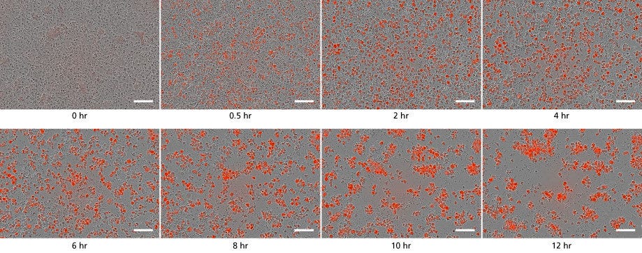 Time lapse of functional microglia phagocytosing bioindicator particles in culture. Over time, cells turn red and aggregate.