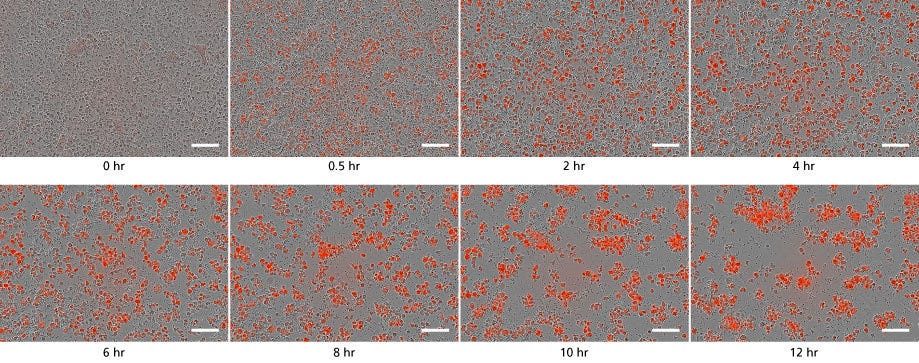 Time lapse of functional microglia phagocytosing bioindicator particles in culture. Over time, cells turn red and aggregate.