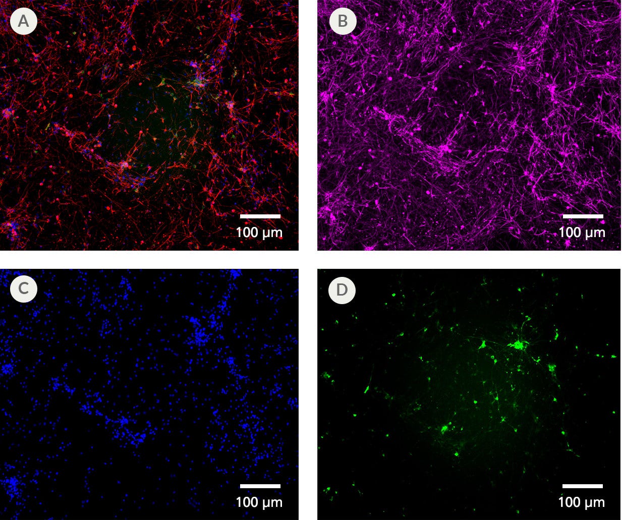 Midbrain-Type Neurons Arise From Neural Progenitor Cells After Culture in STEMdiff™ SMADi Neural Induction Kit and STEMdiff™ Midbrain Culture System