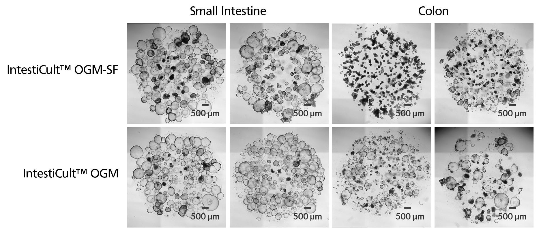 Organoids Grown in IntestiCult™-SF Have a Comparable Morphology to Organoids Grown in IntestiCult Organoid Growth Medium (Human)