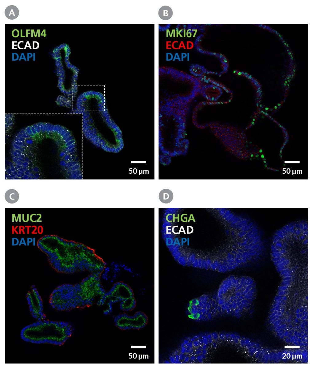 Organoids Grown in IntestiCult™-SF Display Some Characteristics of the Mature Intestinal Epithelium