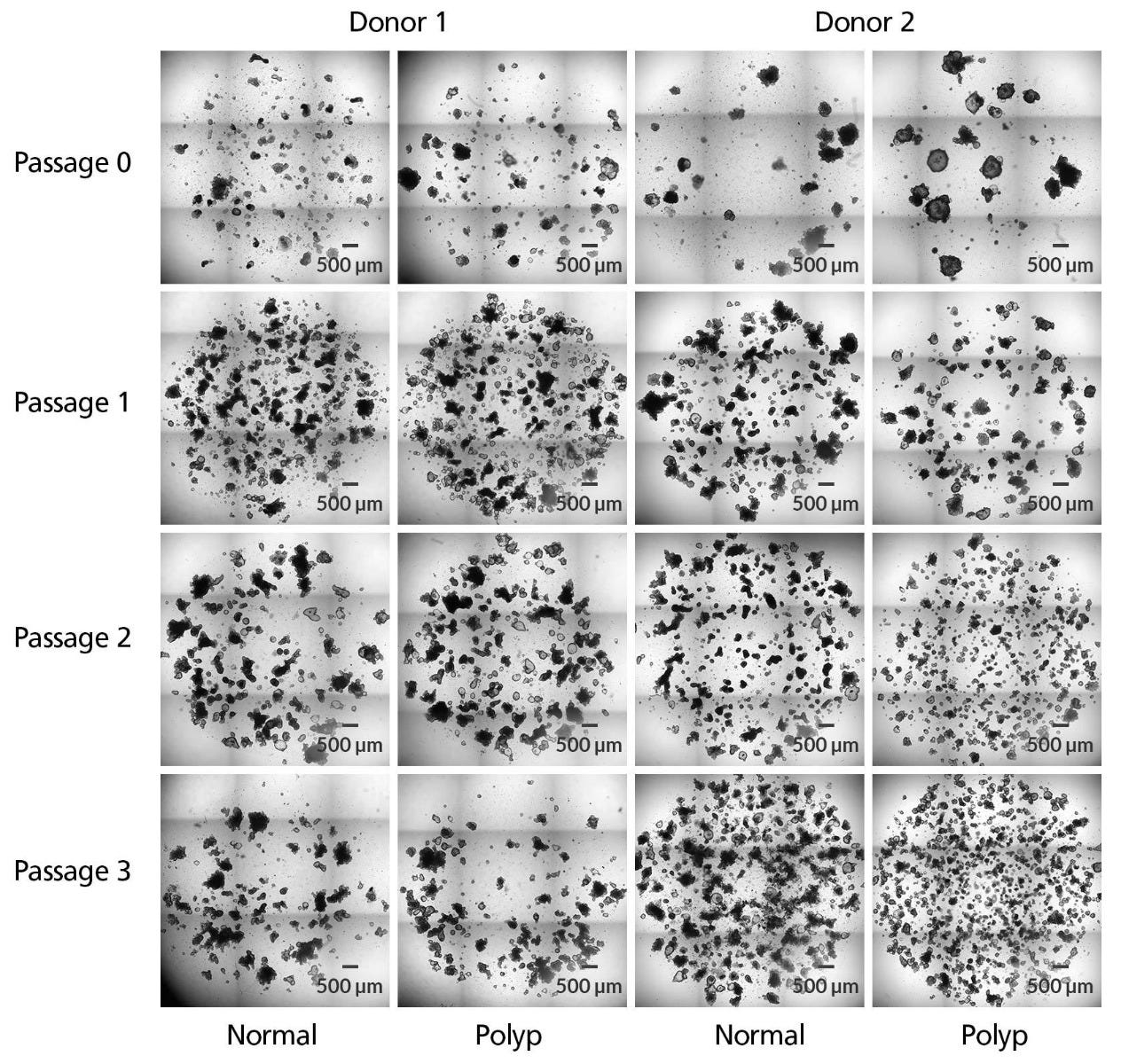 IntestiCult™-SF Enables Efficient Expansion of Intestinal Organoids from Polyp Tissue