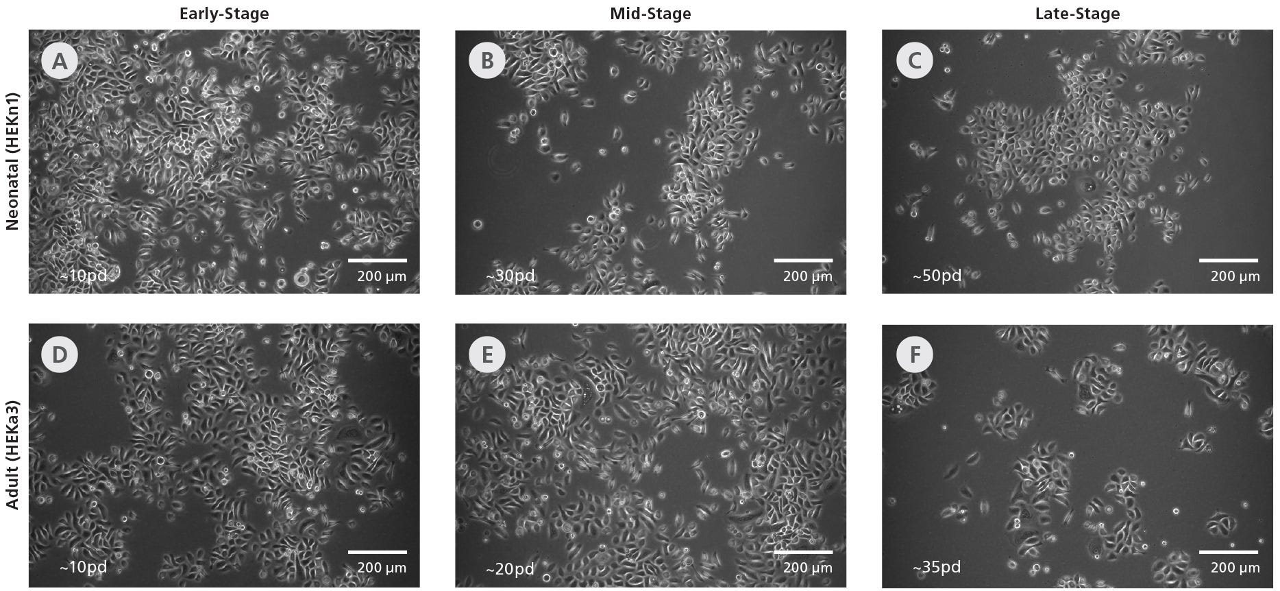 Phase-contrast images showing cobblestone morphology of neonatal and adult human epidermal keratinocytes (HEKs) cultured long-term in DermaCult™ Keratinocyte Expansion Medium.