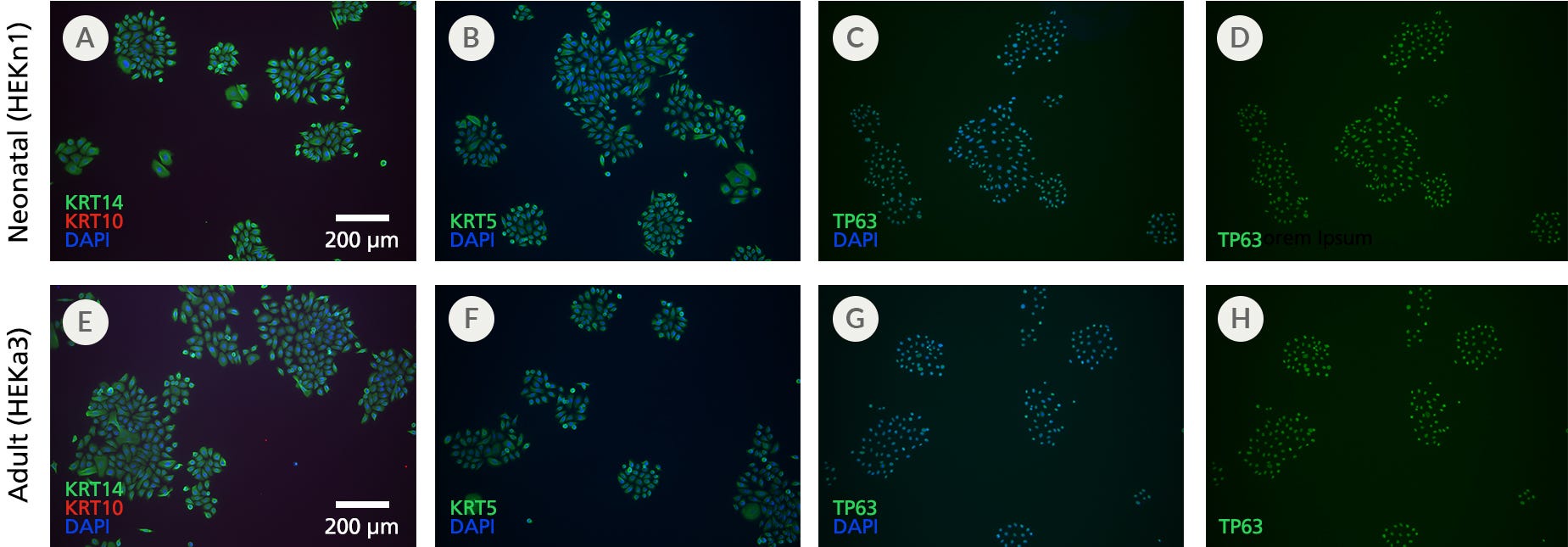 ICC staining of neonatal and adult HEKs maintained in DermaCult™ Keratinocyte Expansion Medium shows expression of basal keratinocytes KRT14, KRT5, and TP63, and absence of the suprabasal marker KRT10.
