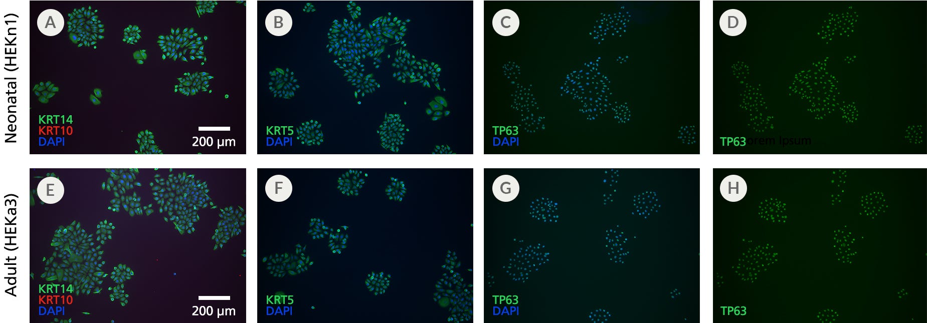 ICC staining of neonatal and adult HEKs maintained in DermaCult™ Keratinocyte Expansion Medium shows expression of basal keratinocytes KRT14, KRT5, and TP63, and absence of the suprabasal marker KRT10. 