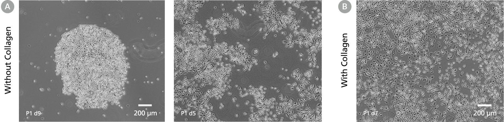 Images showing cobblestone morphology of donor skin tissue samples cultured in DermaCult™ Keratinocyte Expansion Medium with or without collagen.