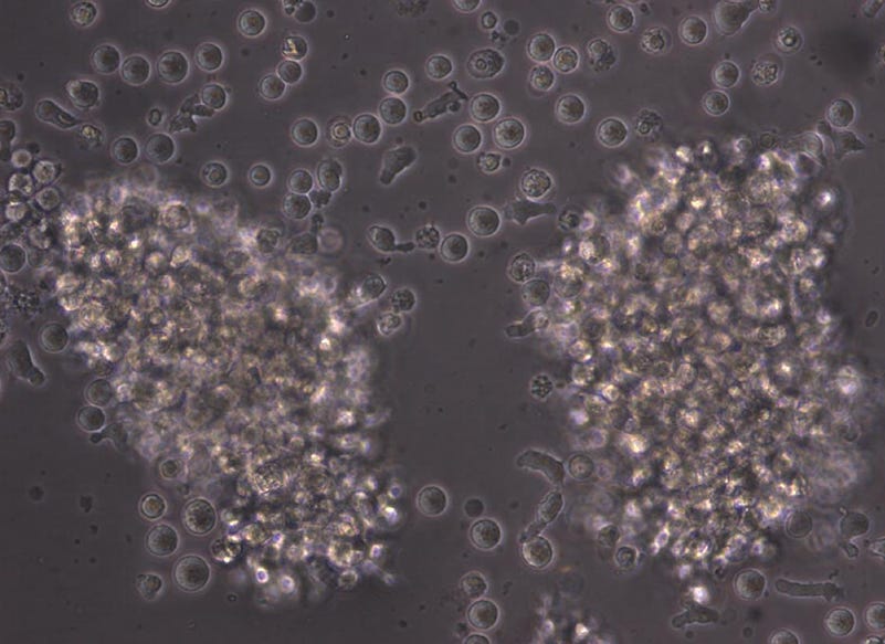 Light Microscopy Image of Cultured Human B Cells