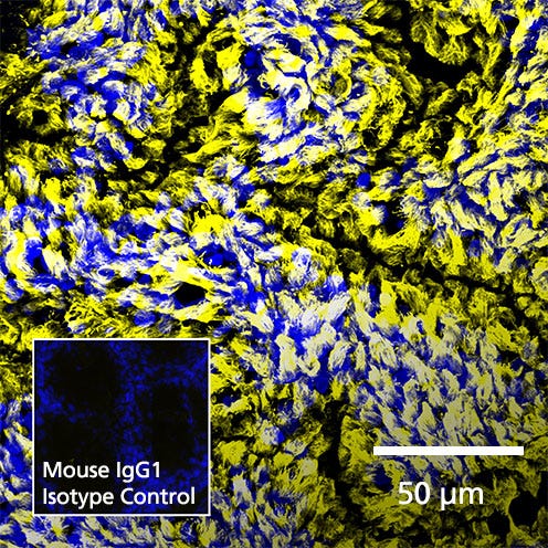 Confocal image of immunostained human bronchial epithelial cells.