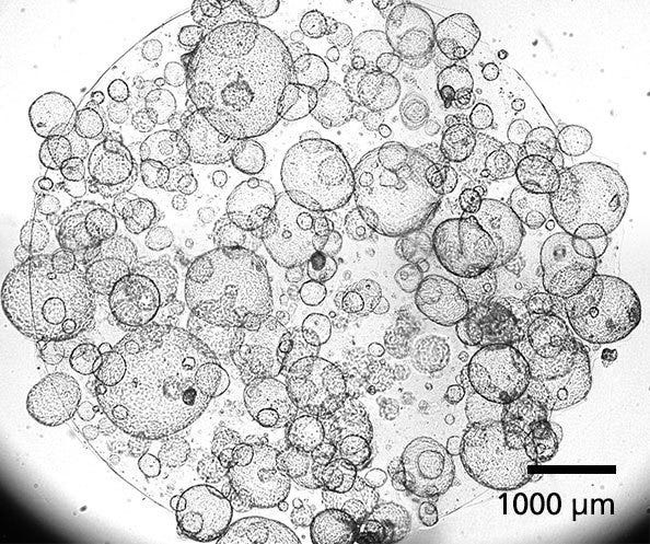 Human Pancreatic Duct Organoids Grown using PancreaCult™ (Human)