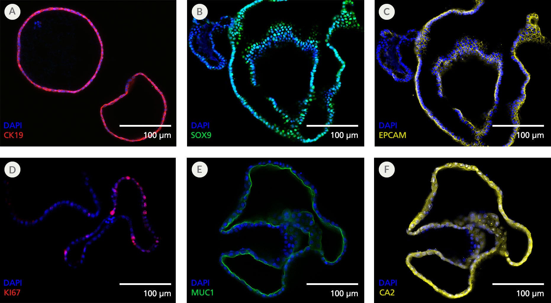 Pancreatic Duct Organoids Display Features of the Pancreatic Ductal Epithelium by ICC Staining