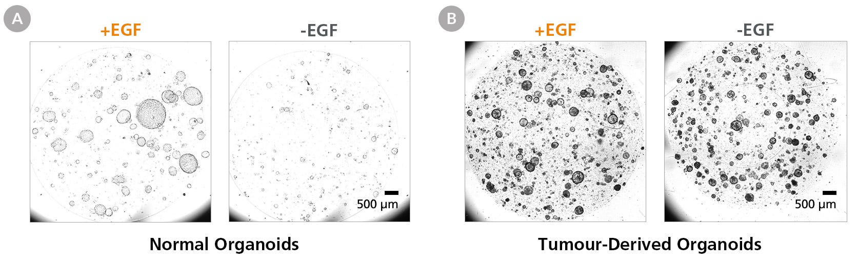 Removing Epidermal Growth Factor (EGF) Abrogates Normal Pancreatic Duct Organoid Growth but Does Not Affect PDAC Organoids Cultured in PancreaCult™ (Human)