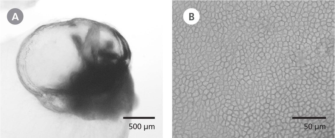Brightfield phase-contrast images of whole choroid plexus organoid and of cuboidal epithelial morphology