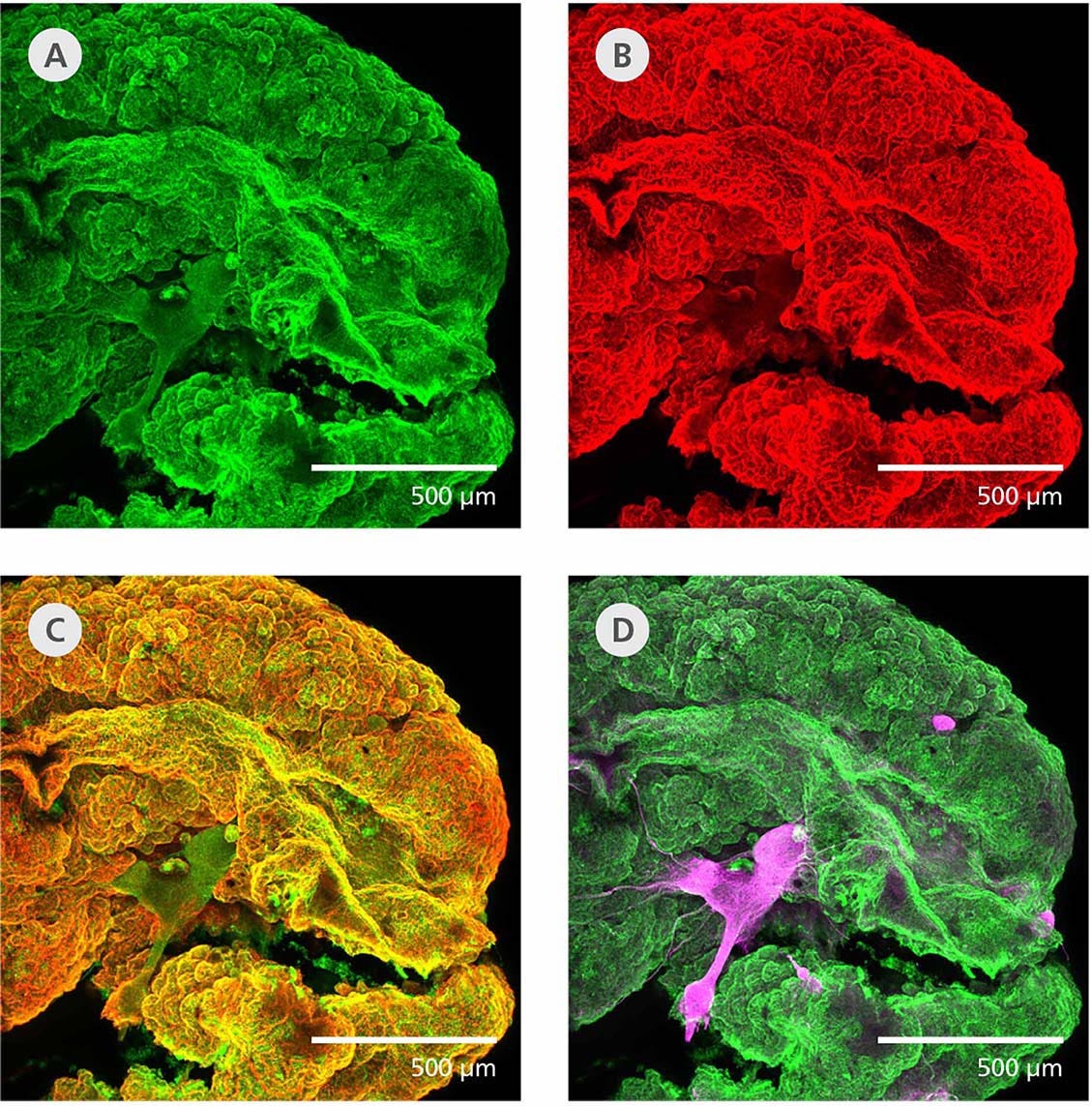 Immunostained choroid plexus organoids showing markers of ependymal epithelium TTR and CLIC6, with separate bundles of MAP2-positive neurons