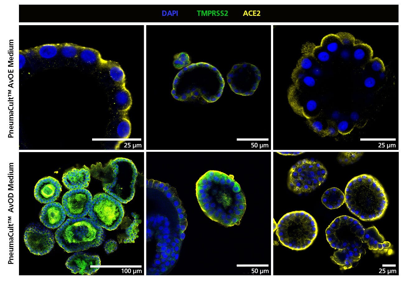 Immunostained alveolar organoids showing expression of SARS-CoV-2 entry markers.