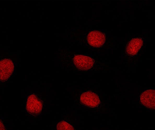 Fluorescent Microscope Image of Cell Cultures
