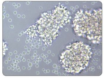 Activated Morphology of Human T Cells Stimulated With ImmunoCult™ Human CD3/CD28/CD2 T Cell Activator